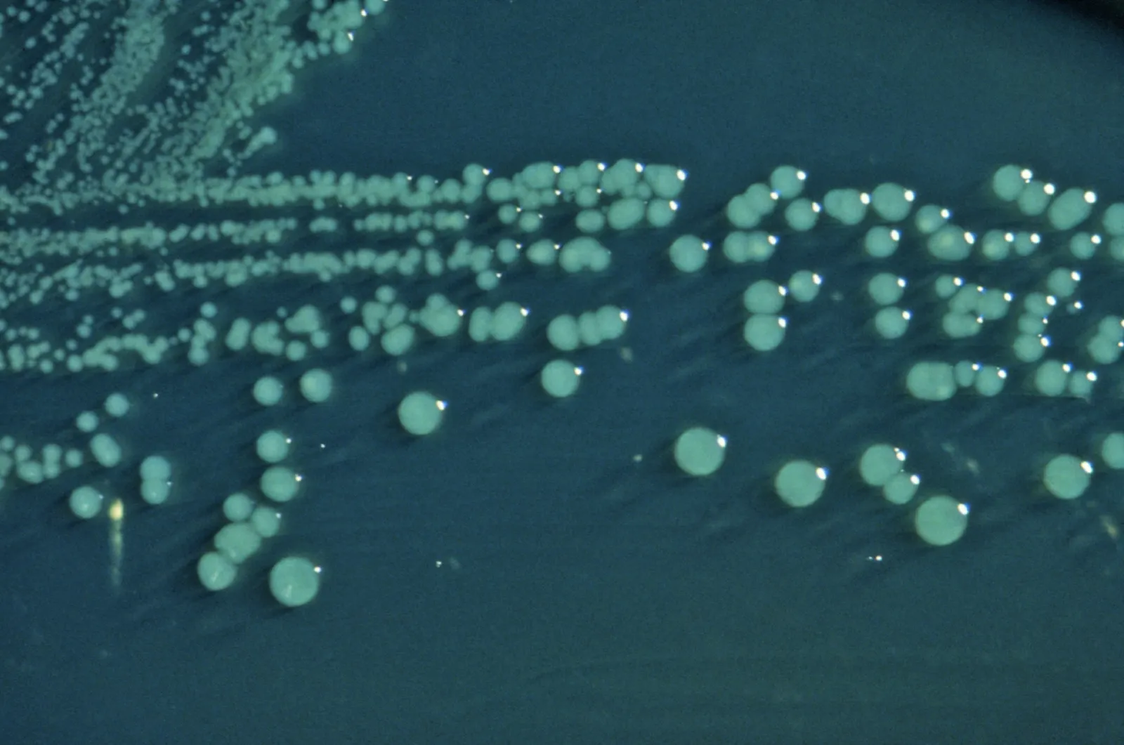 Imagen microscópica de la bacteria Shigella, del tipo que provocó la infección