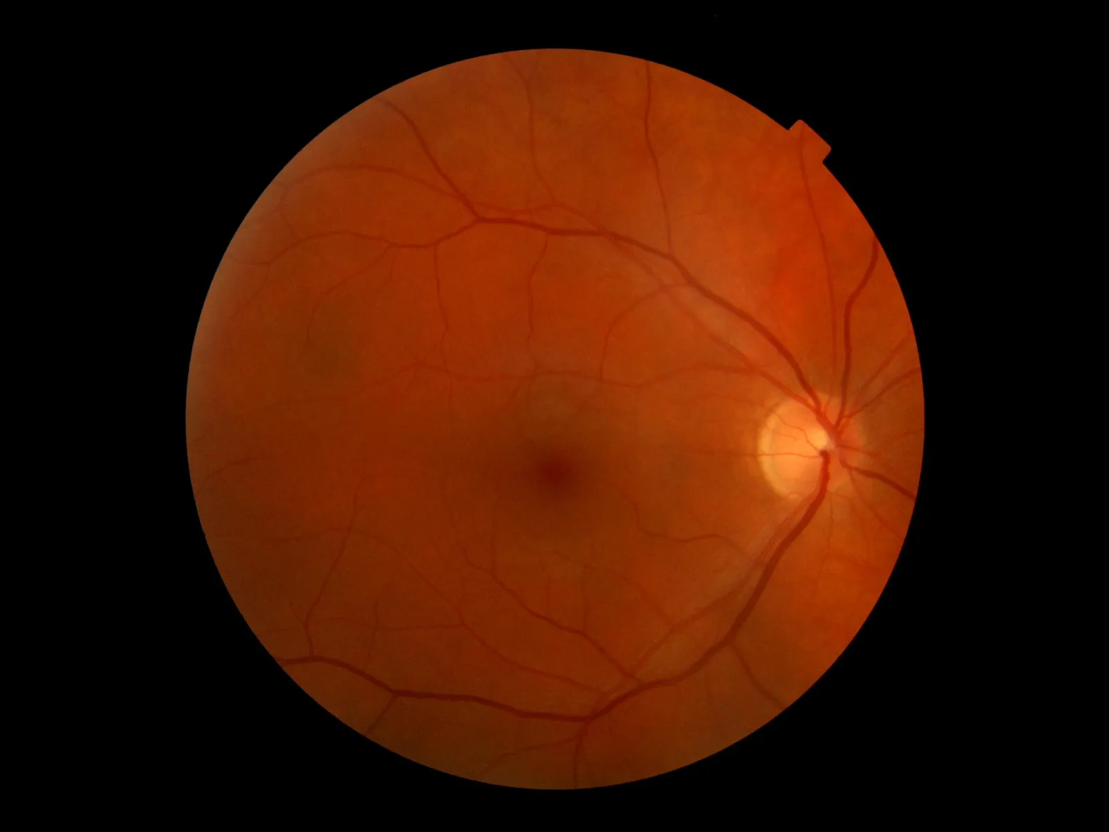 Primer plano de un ojo humano