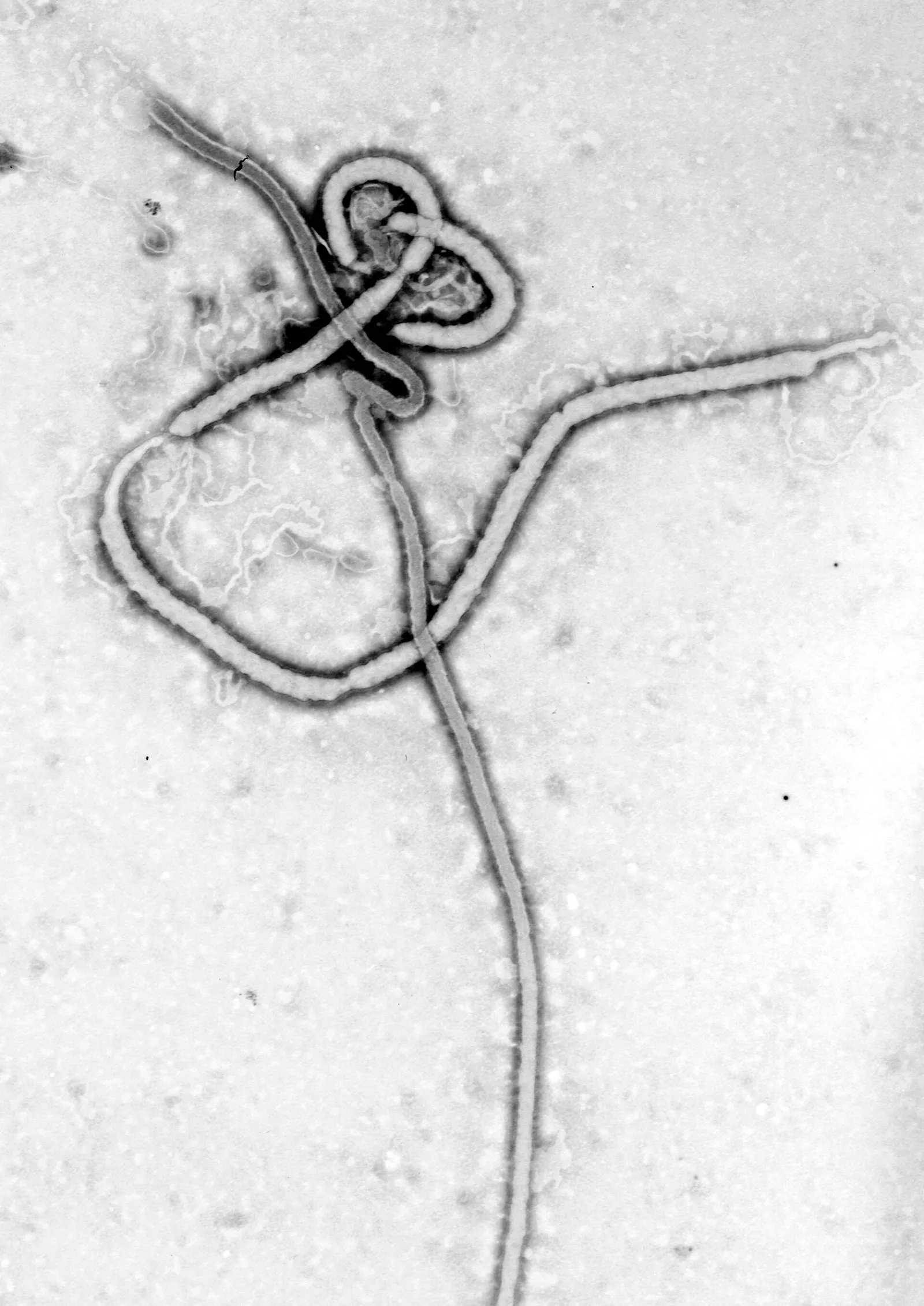 Imagen del virus del ébola obtenida con microscopio electrónico (imagen de archivo)