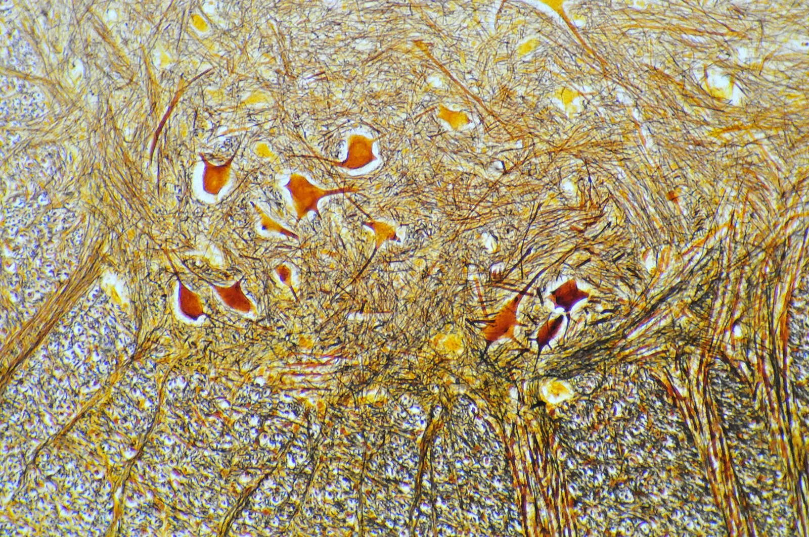 Neuronas de la médula espinal observadas al microscopio (imagen de archivo)